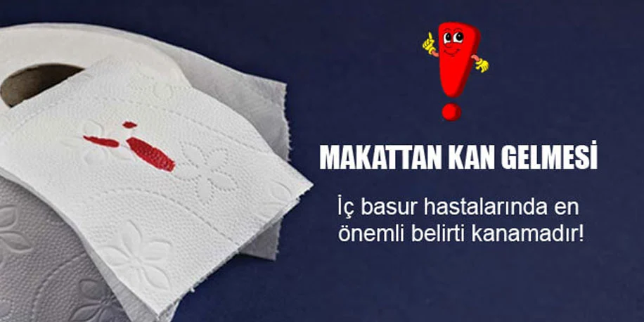 Basur belirtileri nelerdir