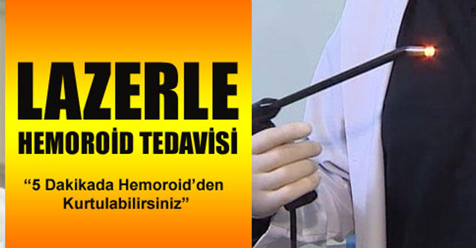 Lazerle basur tedavisi