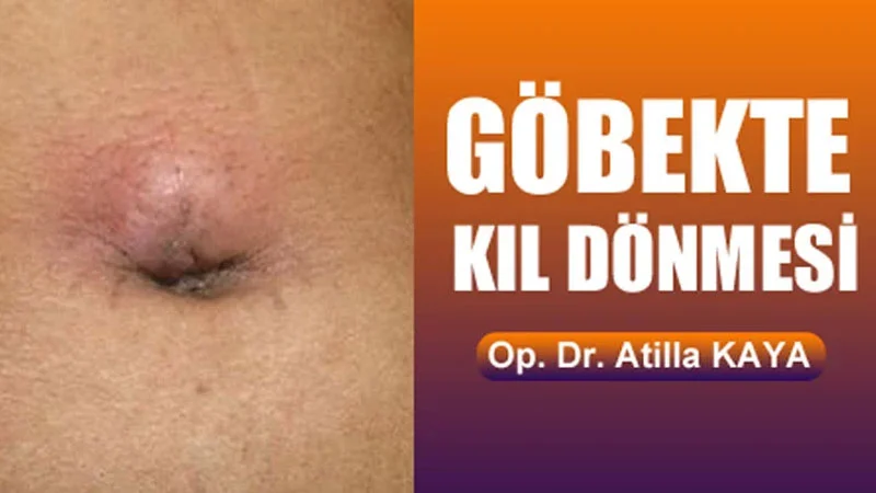 Göbekte kıl dönmesi olur mu